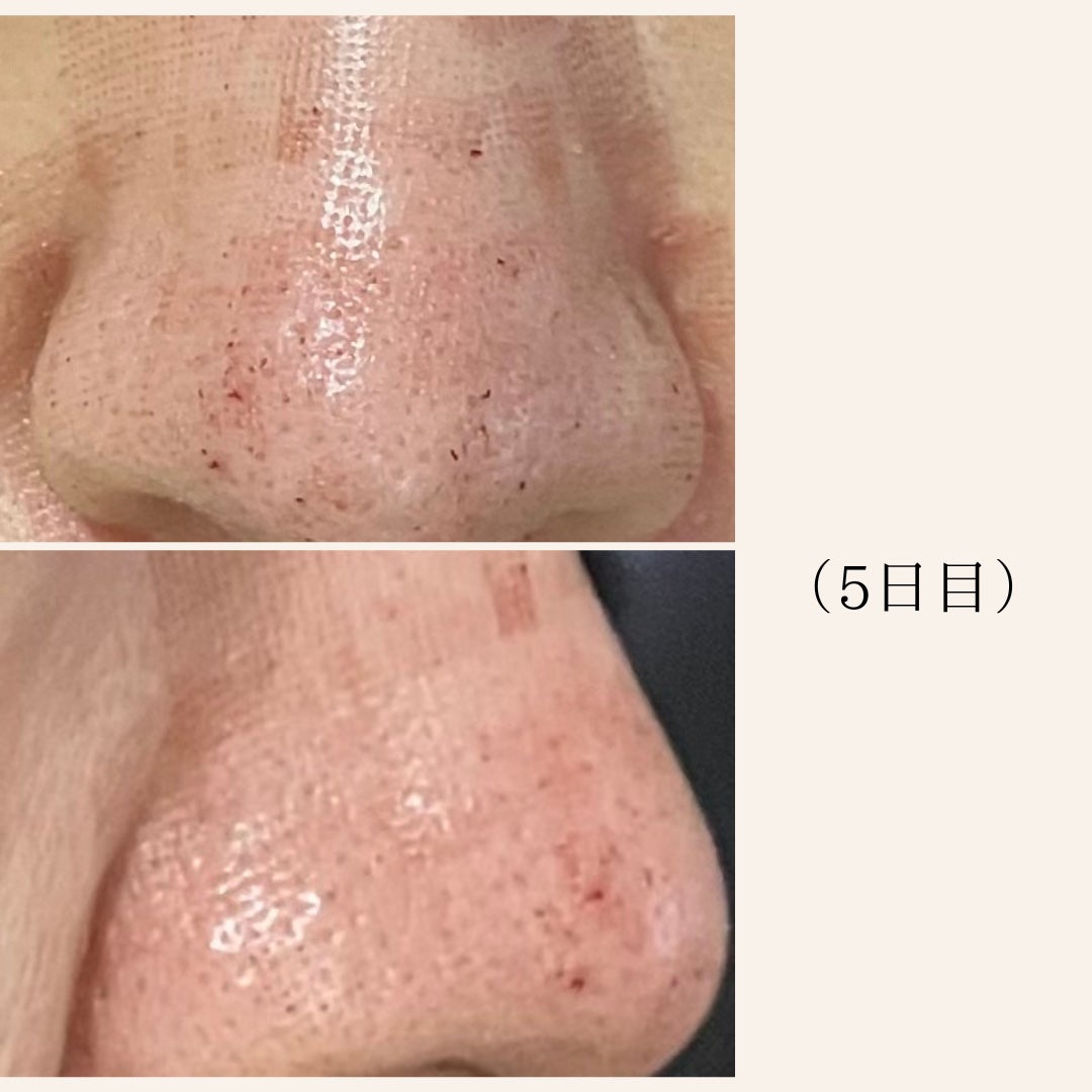 アルティミューン™ パワライジング セラム/SHISEIDO/美容液を使ったクチコミ(4枚目)