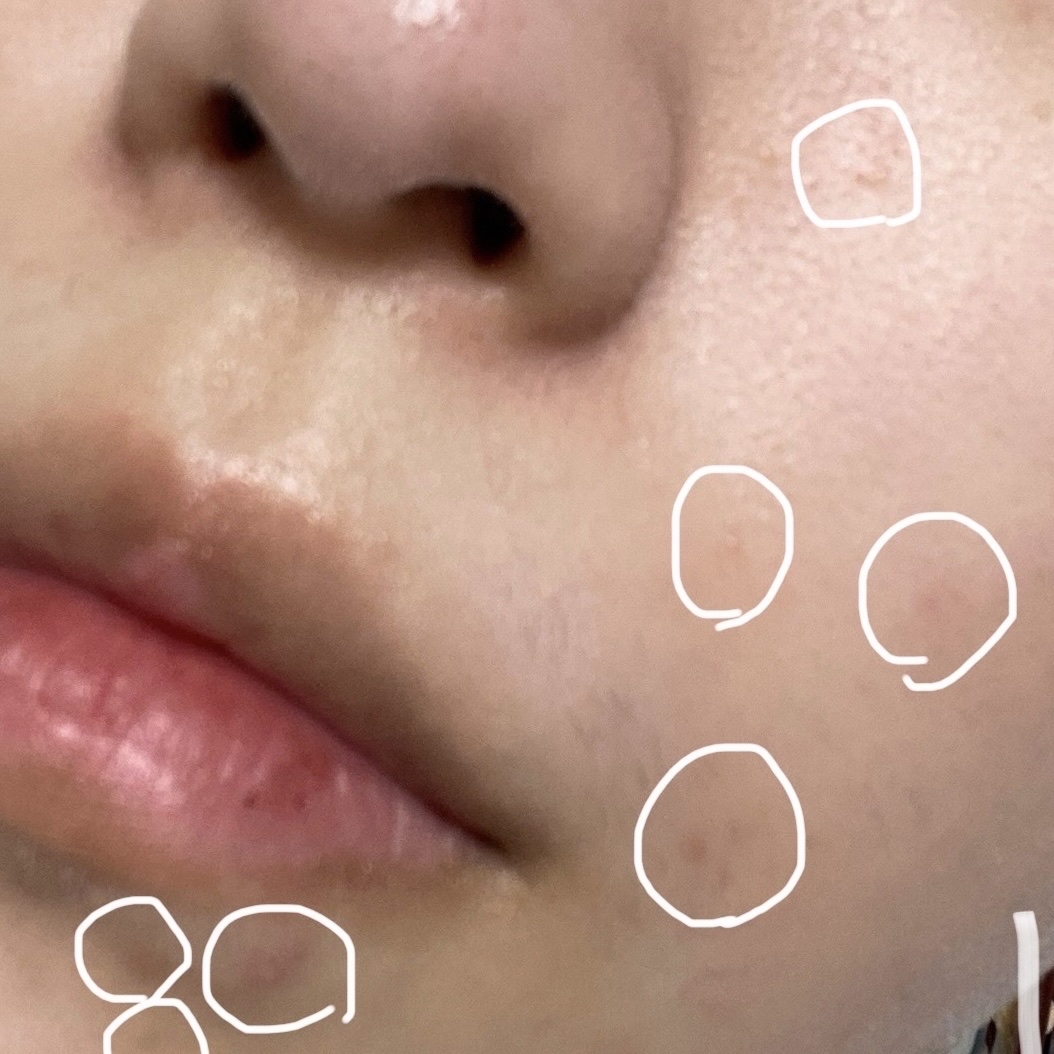 レチノール0.3 ナイアシンリニューイングセラム/Anua/美容液を使ったクチコミ（3枚目）