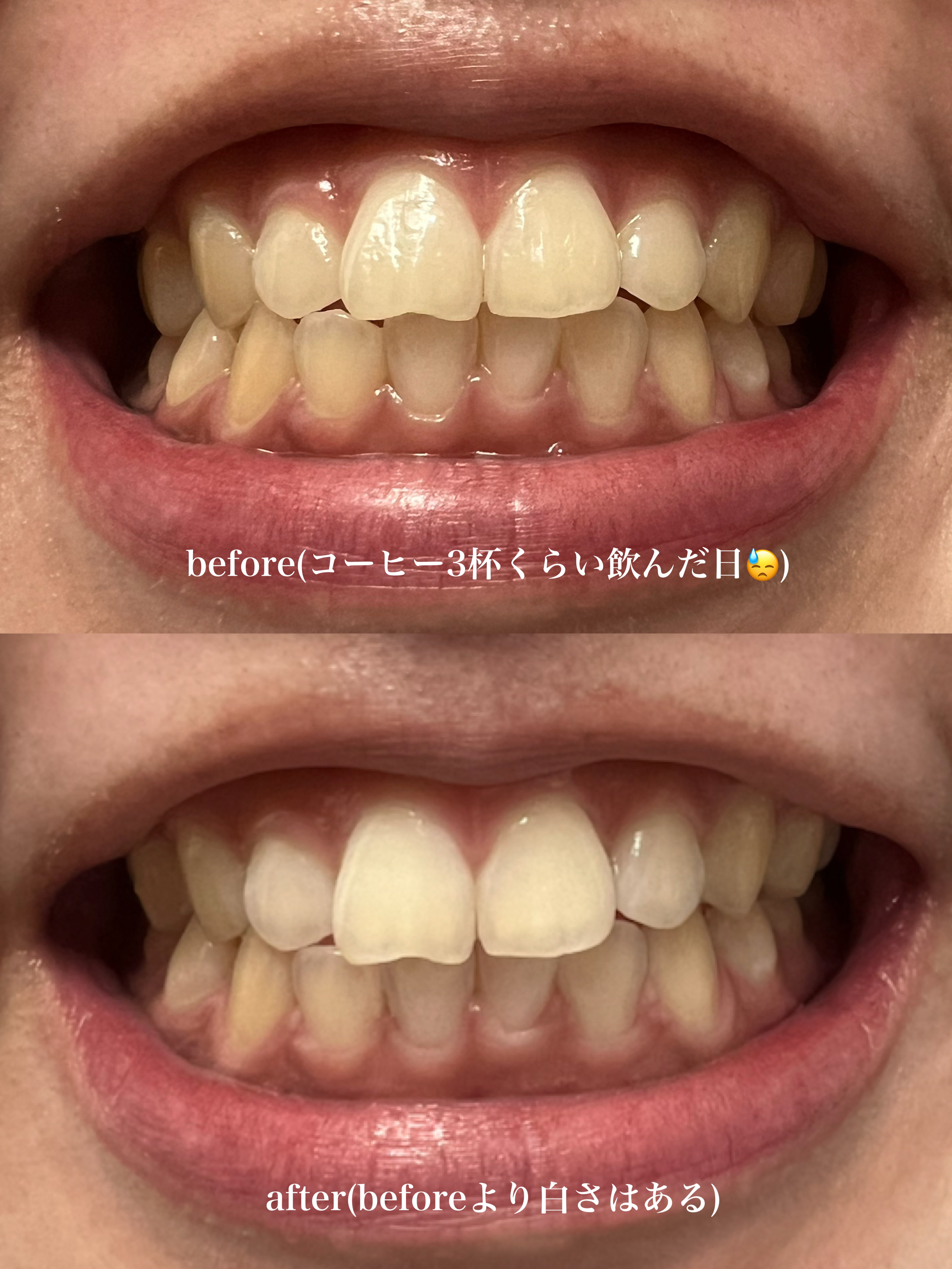 NONIOプラスホワイトニングハミガキ/NONIO/歯磨き粉を使ったクチコミ（3枚目）