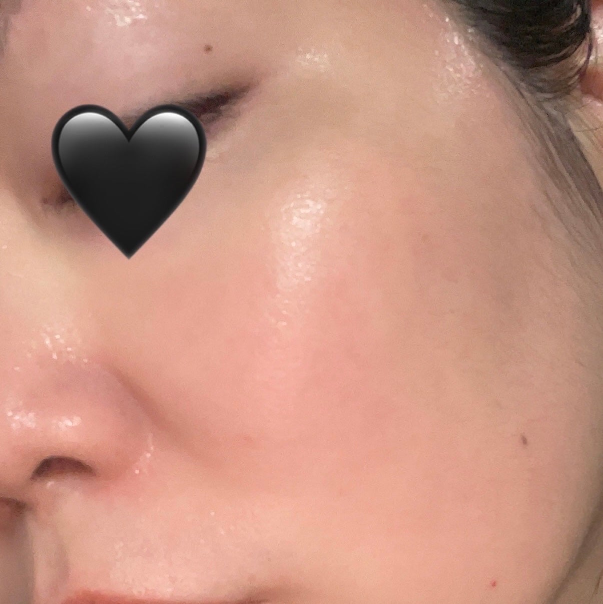 マデカッソシド エッセンシャルマスク/MEDIHEAL/シートマスク・パックを使ったクチコミ(4枚目)