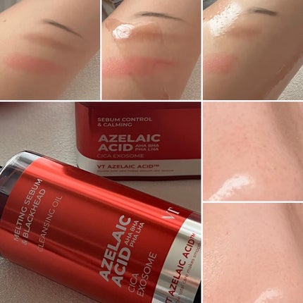 AZケア クレンジングオイル/VT/オイルクレンジングを使ったクチコミ(4枚目)