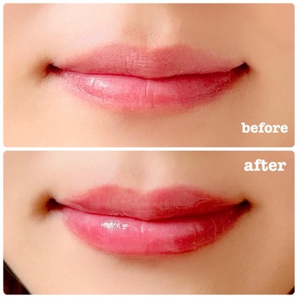 Q+Me ボムショットリッププランパー+/AGARISM/リッププランパーを使ったクチコミ(6枚目)