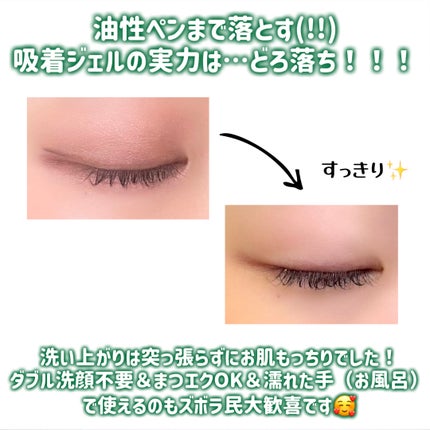 モッチスキン吸着クレンジング/MoccHi SKIN/クレンジングジェルを使ったクチコミ(4枚目)