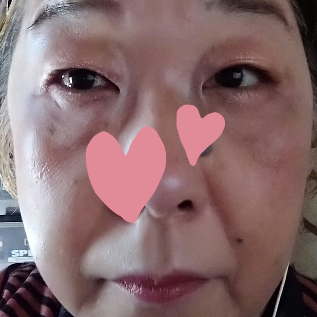 M クッション ファンデーション(プロカバー)/MISSHA/クッションファンデーションを使ったクチコミ（3枚目）