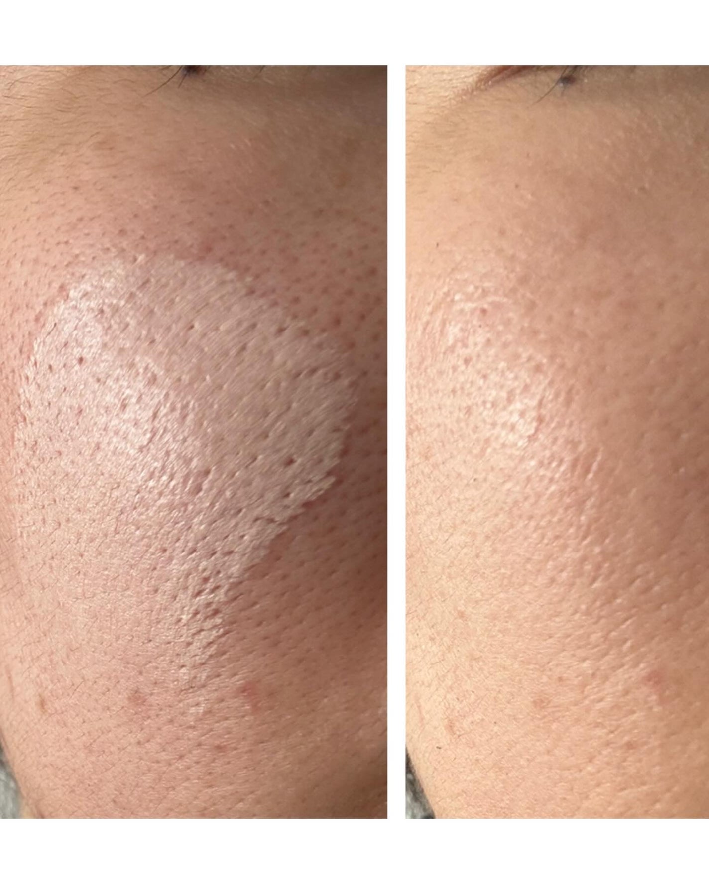 パンテノールバリアクッション/COSNORI/クッションファンデーションを使ったクチコミ(10枚目)