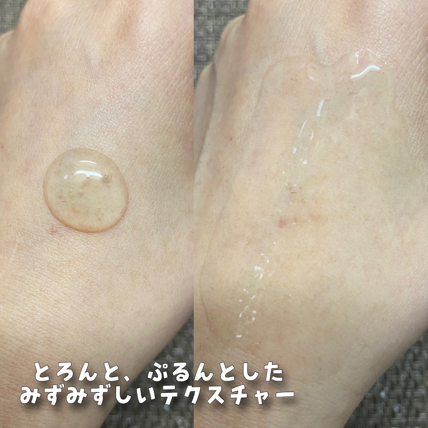 あこ❀cosme on LIPS 「(MAXCLINIC様よりご提供いただきました❤︎)MAXCL..」(4枚目)