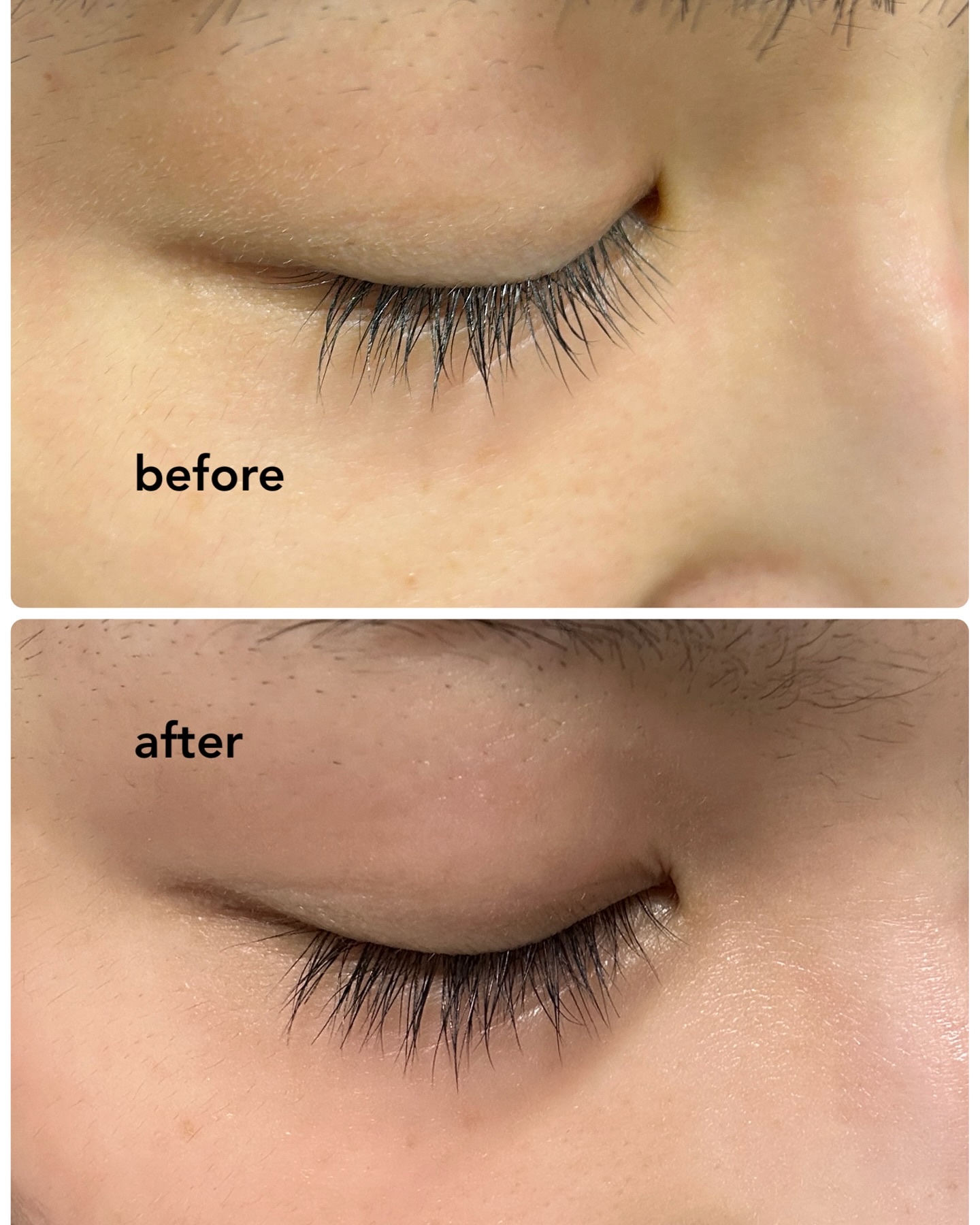 ラッシュアディクト アイラッシュ コンディショニング セラム アドバンス/soaddicted/まつげ美容液を使ったクチコミ（3枚目）