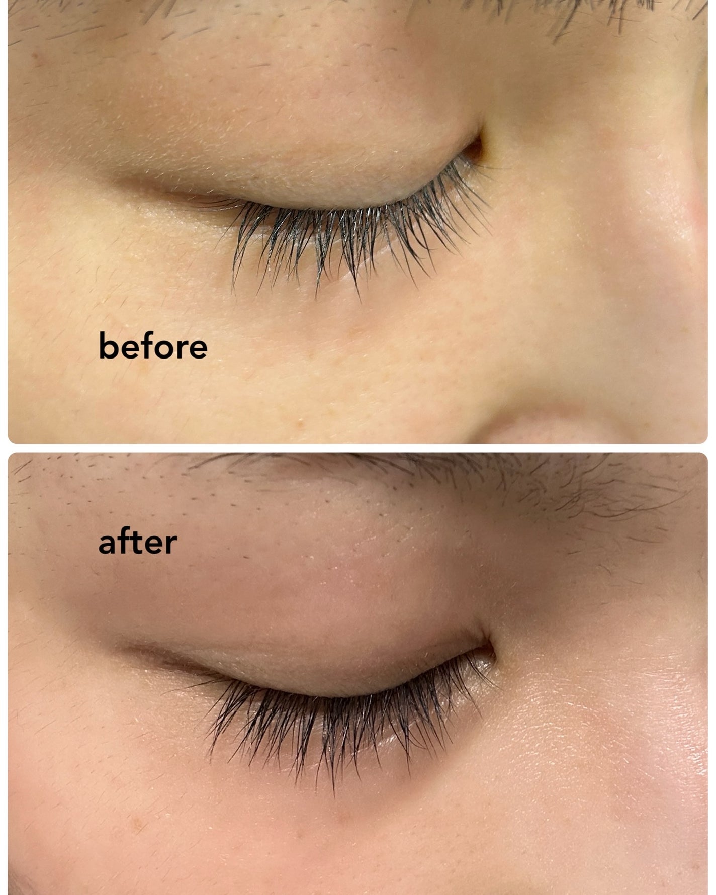 ラッシュアディクト アイラッシュ コンディショニング セラム アドバンス/soaddicted/まつげ美容液を使ったクチコミ(3枚目)