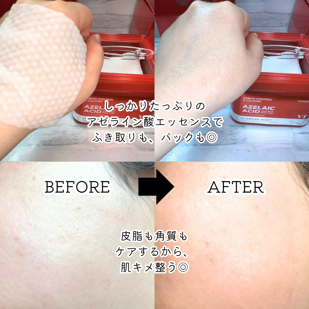 AZケア クレンジングオイル/VT/オイルクレンジングを使ったクチコミ(4枚目)