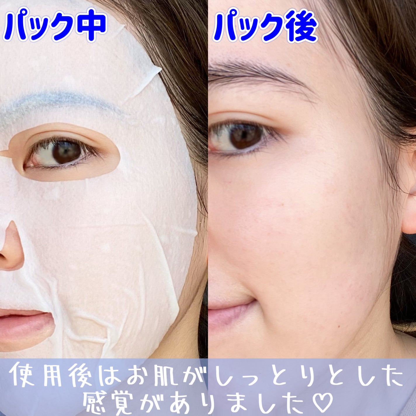 リアルバリア エクストリームクリームマスク/Real Barrier/シートマスク・パックを使ったクチコミ(7枚目)