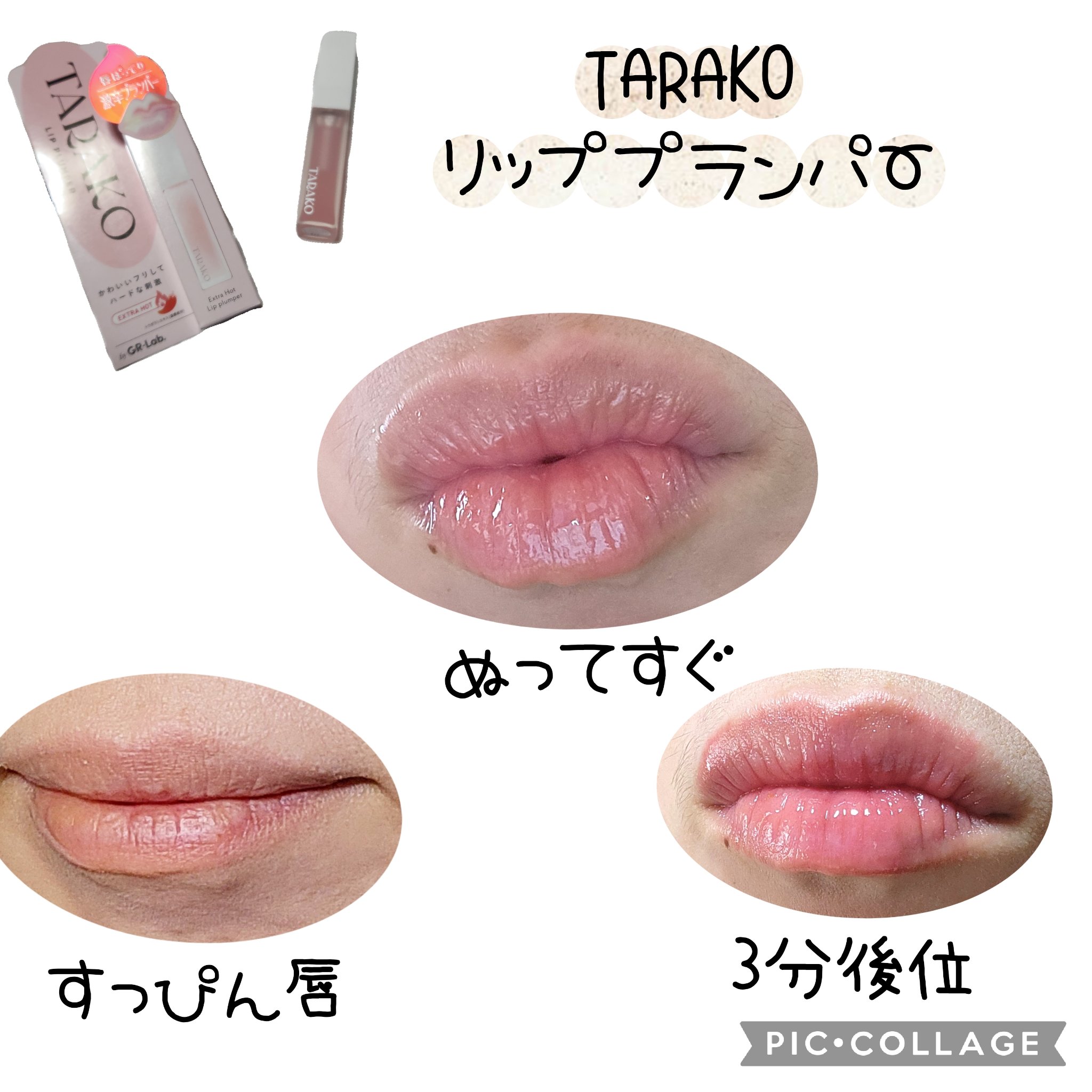 TARAKO  リッププランパー/GR-Lab./リップグロスを使ったクチコミ（3枚目）