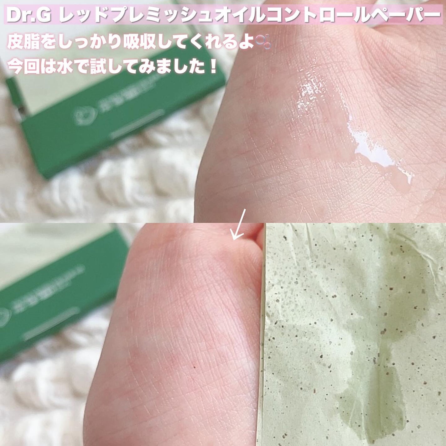 エイクリアスポットキュアパッチ/Dr.G/その他スキンケアを使ったクチコミ(3枚目)