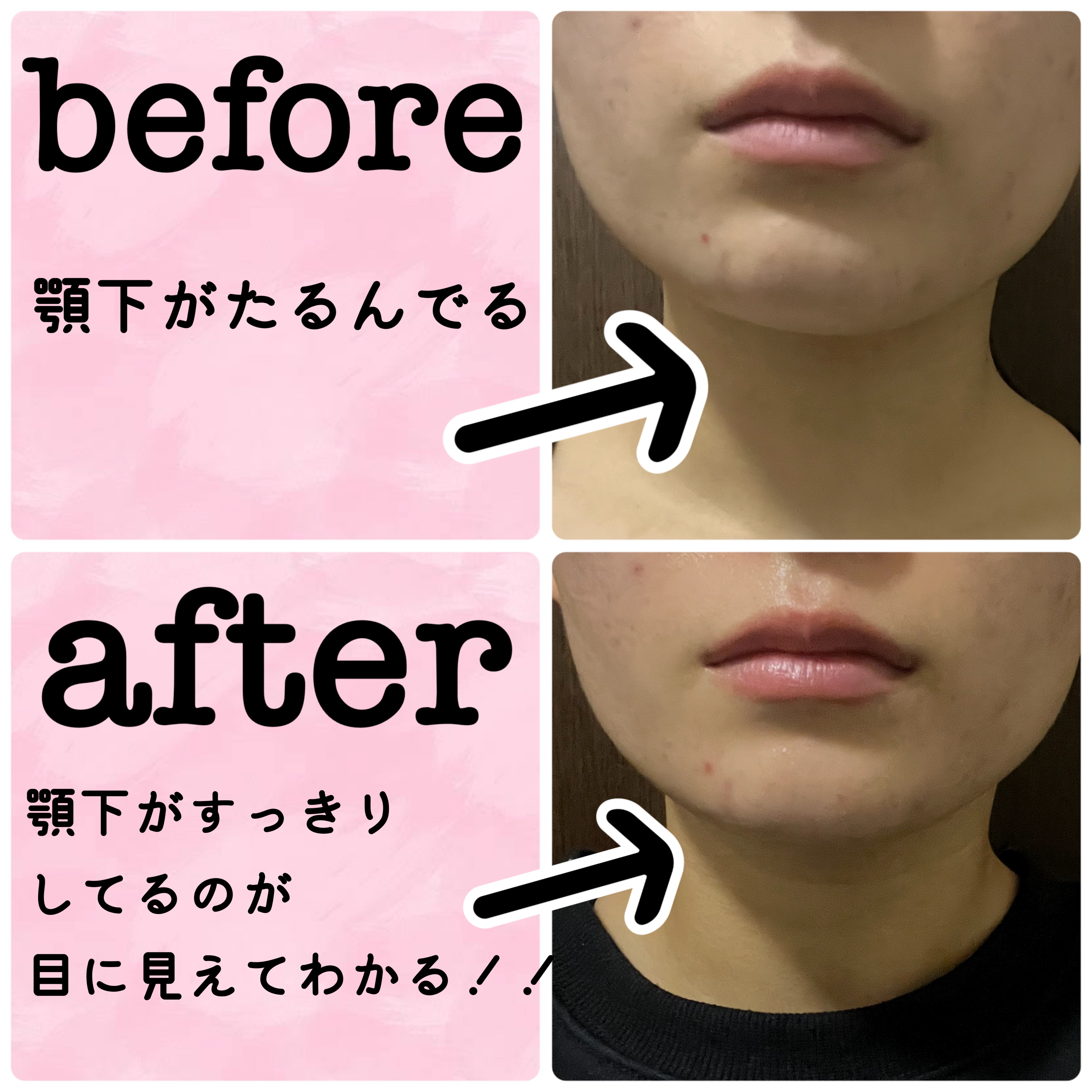 9番 NMNバイオリフトラッピングマスク/numbuzin/シートマスク・パックを使ったクチコミ（3枚目）