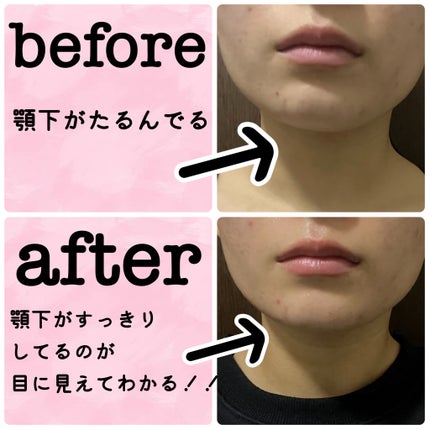 9番 NMNバイオリフトラッピングマスク/numbuzin/シートマスク・パックを使ったクチコミ(3枚目)