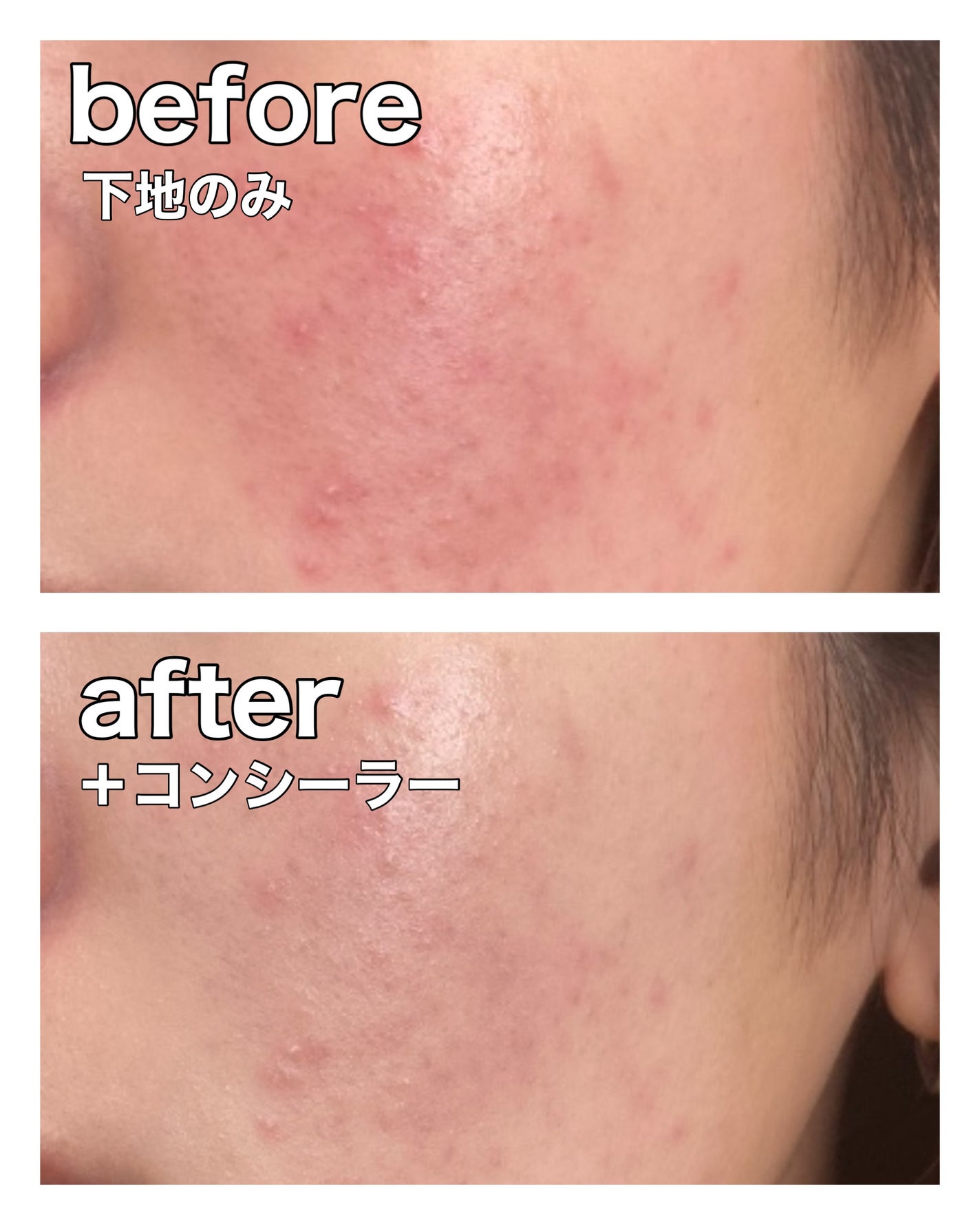 デザイニングカラーリクイド/KANEBO/リキッドコンシーラーを使ったクチコミ(3枚目)