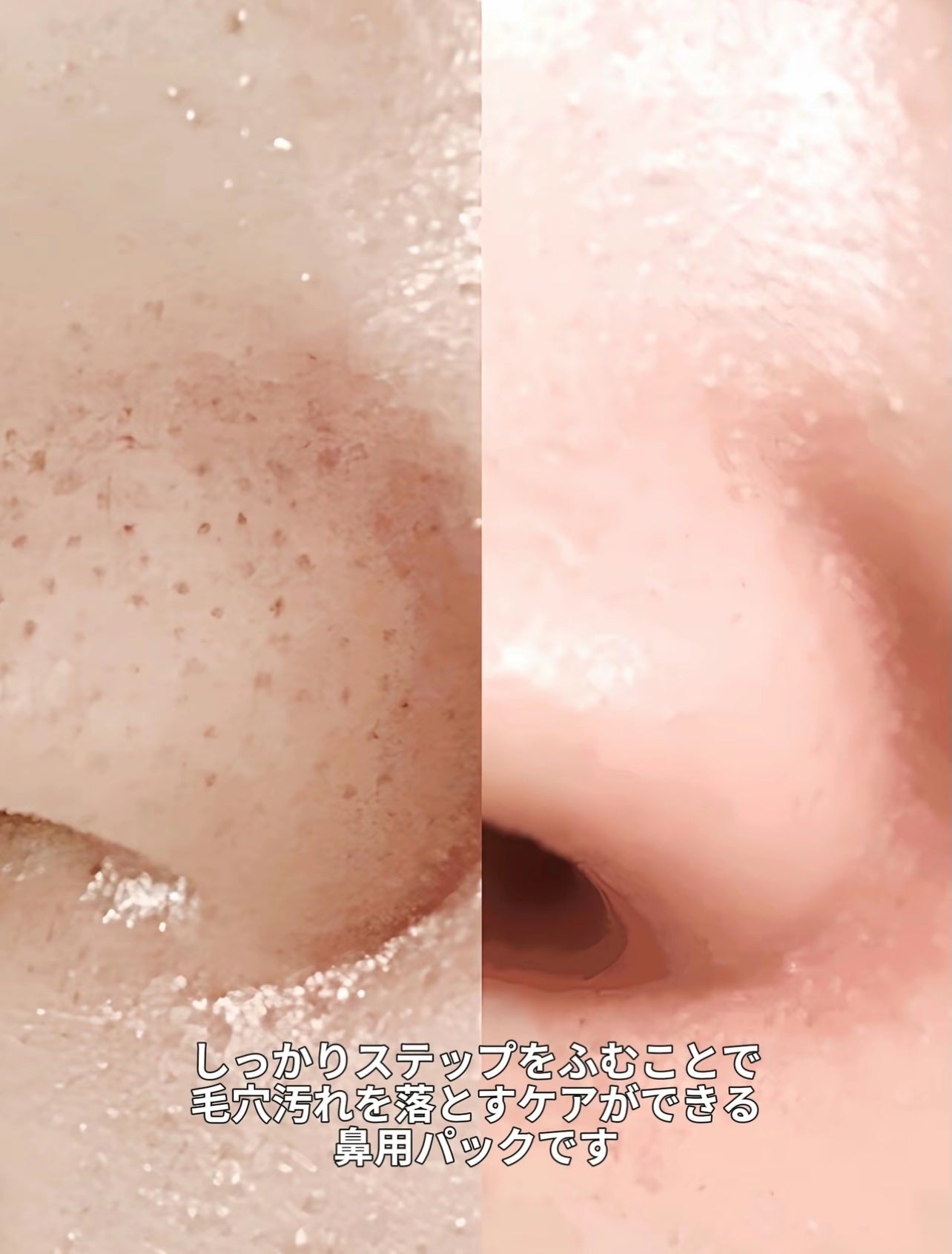 毛穴モップ (3STEP NOSE PACK)/YAMMY’S TOY/洗い流すパック・マスクを使ったクチコミ(7枚目)