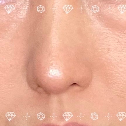 むにゅっとハイライター/キャンメイク/クリームハイライトを使ったクチコミ(3枚目)