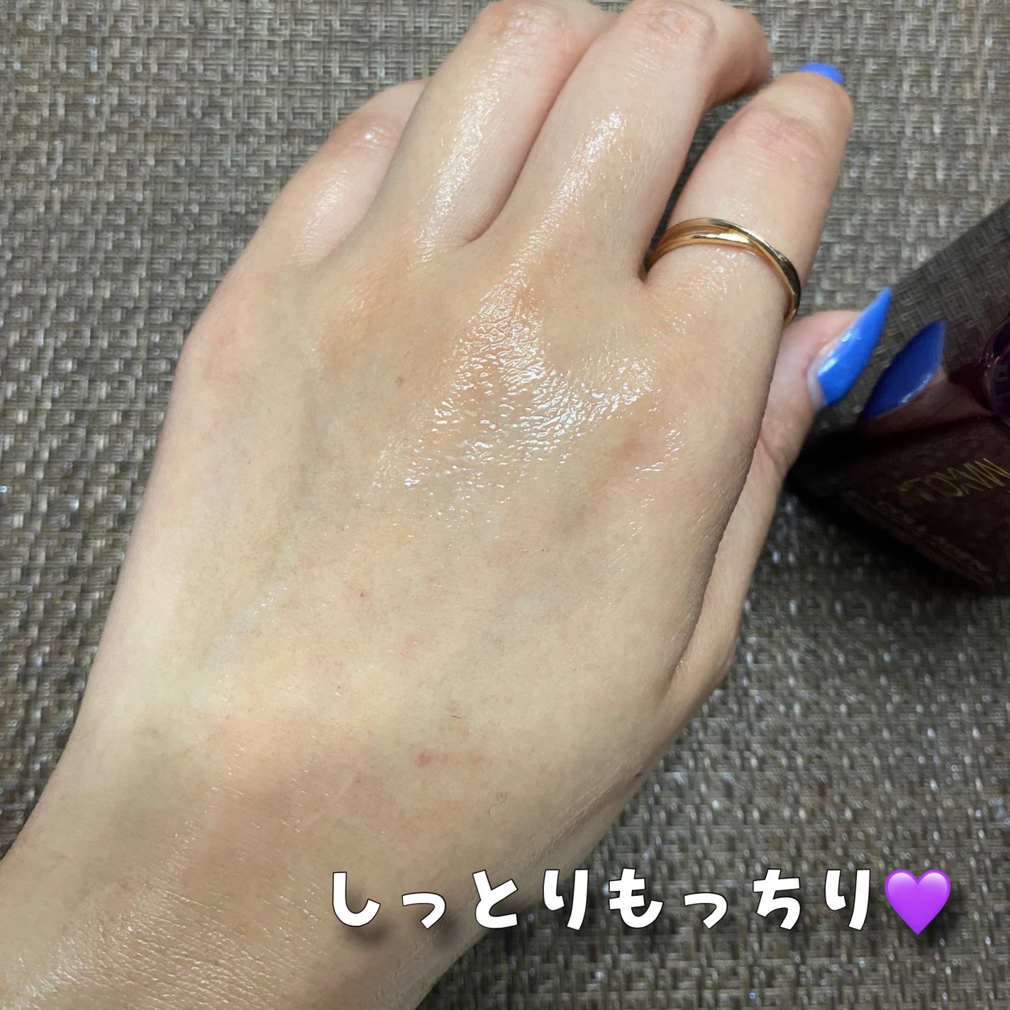 あこ❀cosme on LIPS 「(MAXCLINIC様よりご提供いただきました❤︎)MAXCL..」(5枚目)