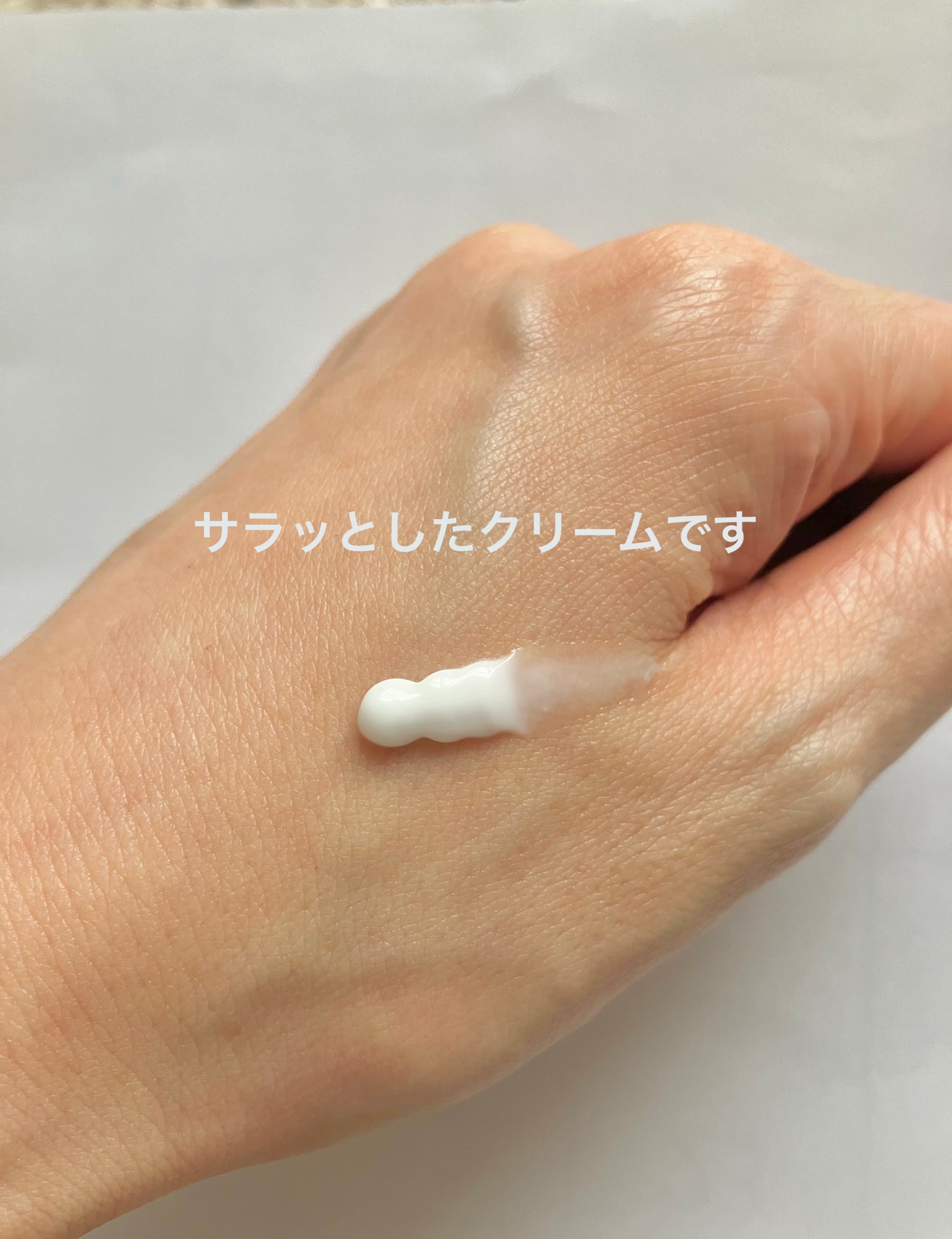 アクネキュアクリーム(医薬品)/IHADA/その他を使ったクチコミ(2枚目)