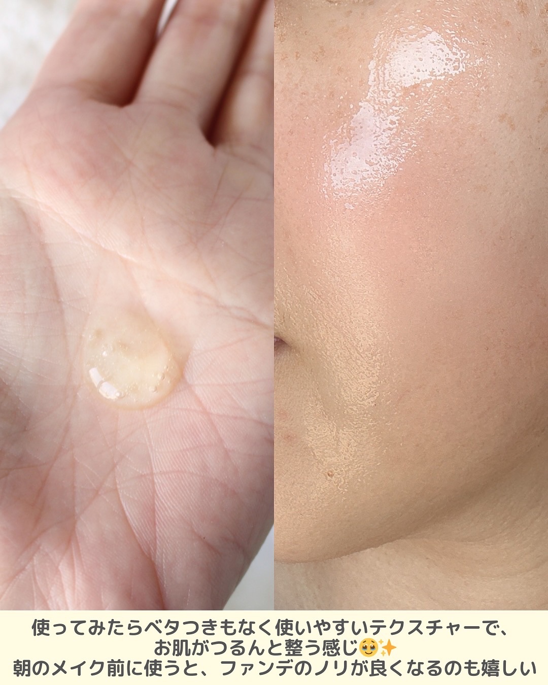 ビタペアCPDRN水潤セラム/ネイチャーリパブリック/美容液を使ったクチコミ（3枚目）