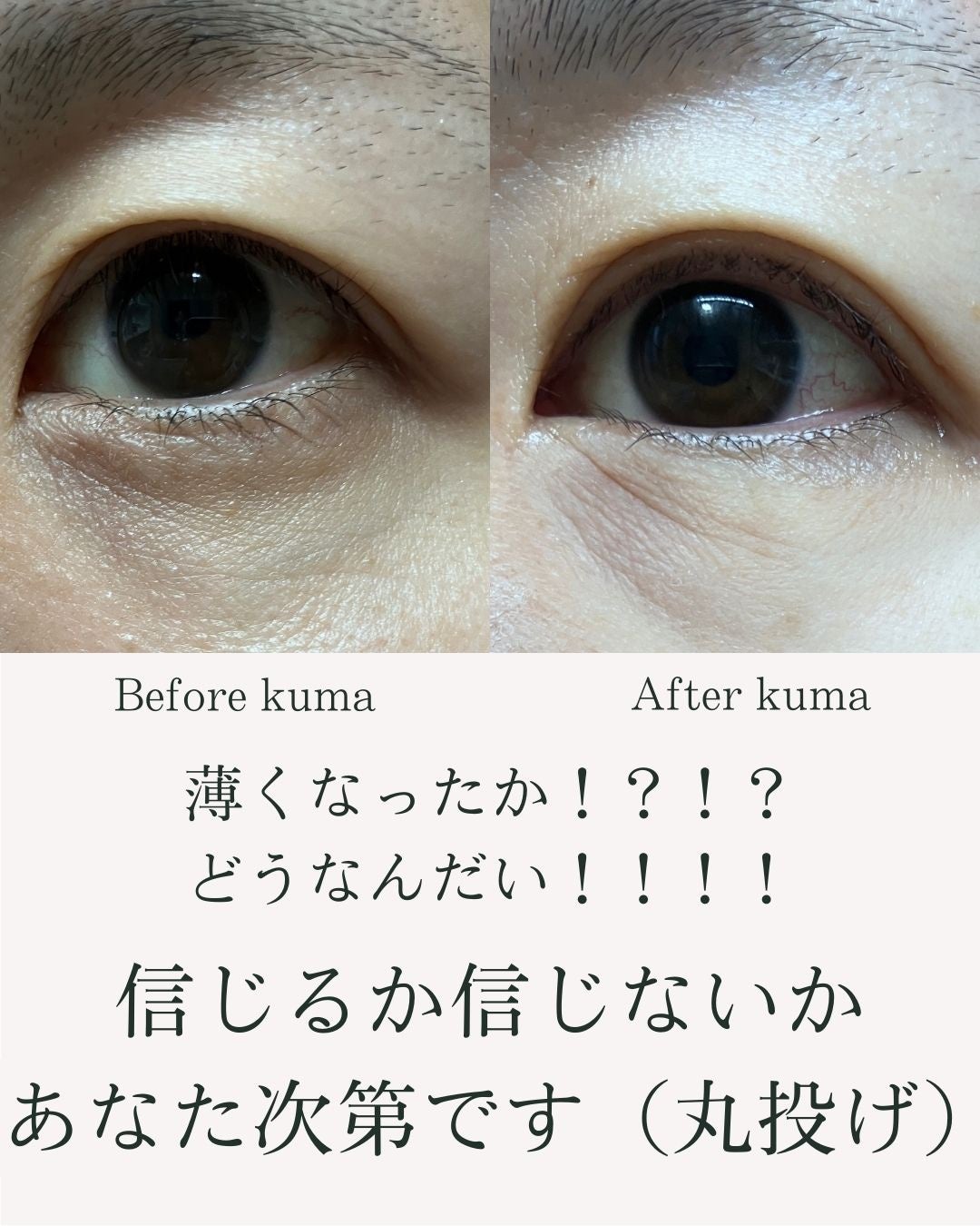 アイファルトアイバッククリーム/Dr.Melaxin/アイケア・アイクリームを使ったクチコミ(8枚目)