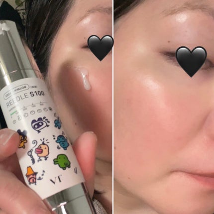 リードルショット100/VT/美容液を使ったクチコミ(4枚目)