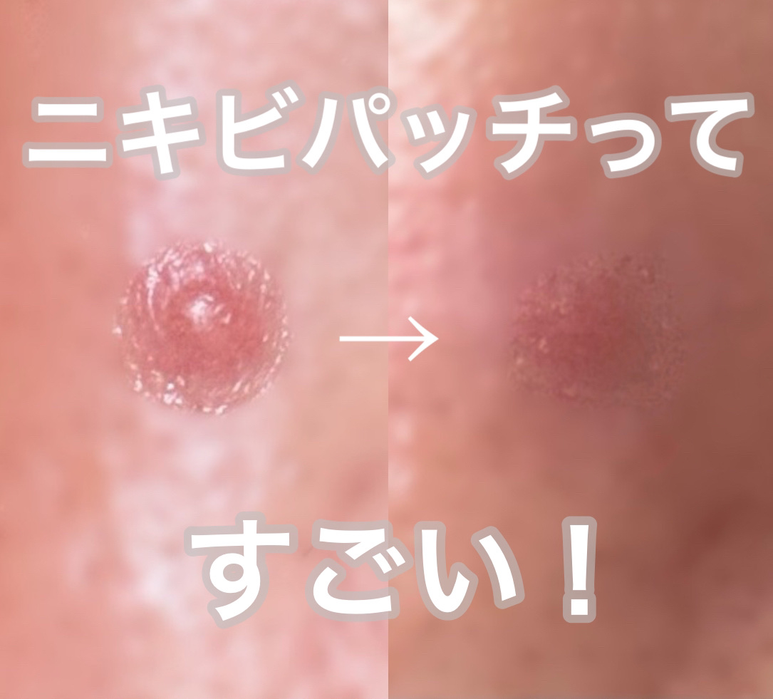 オリーブヤング ケアプラス/Olive Young/その他を使ったクチコミ（1枚目）