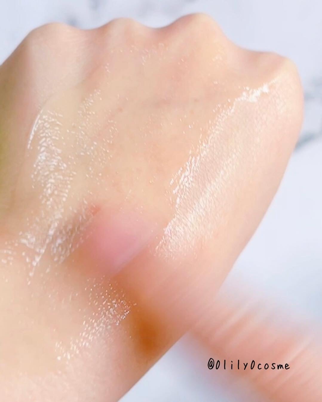 ナイアシンアミド 5% ボディローション/b.clinicx/ボディローションを使ったクチコミ(5枚目)