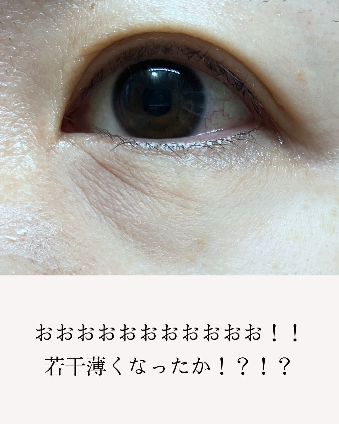 アイファルトアイバッククリーム/Dr.Melaxin/アイケア・アイクリームを使ったクチコミ(7枚目)