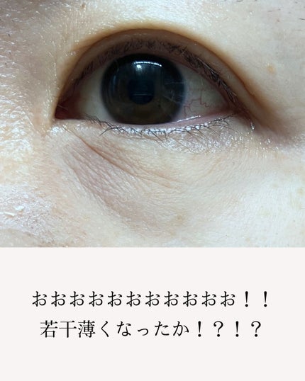 アイファルトアイバッククリーム/Dr.Melaxin/アイケア・アイクリームを使ったクチコミ(7枚目)