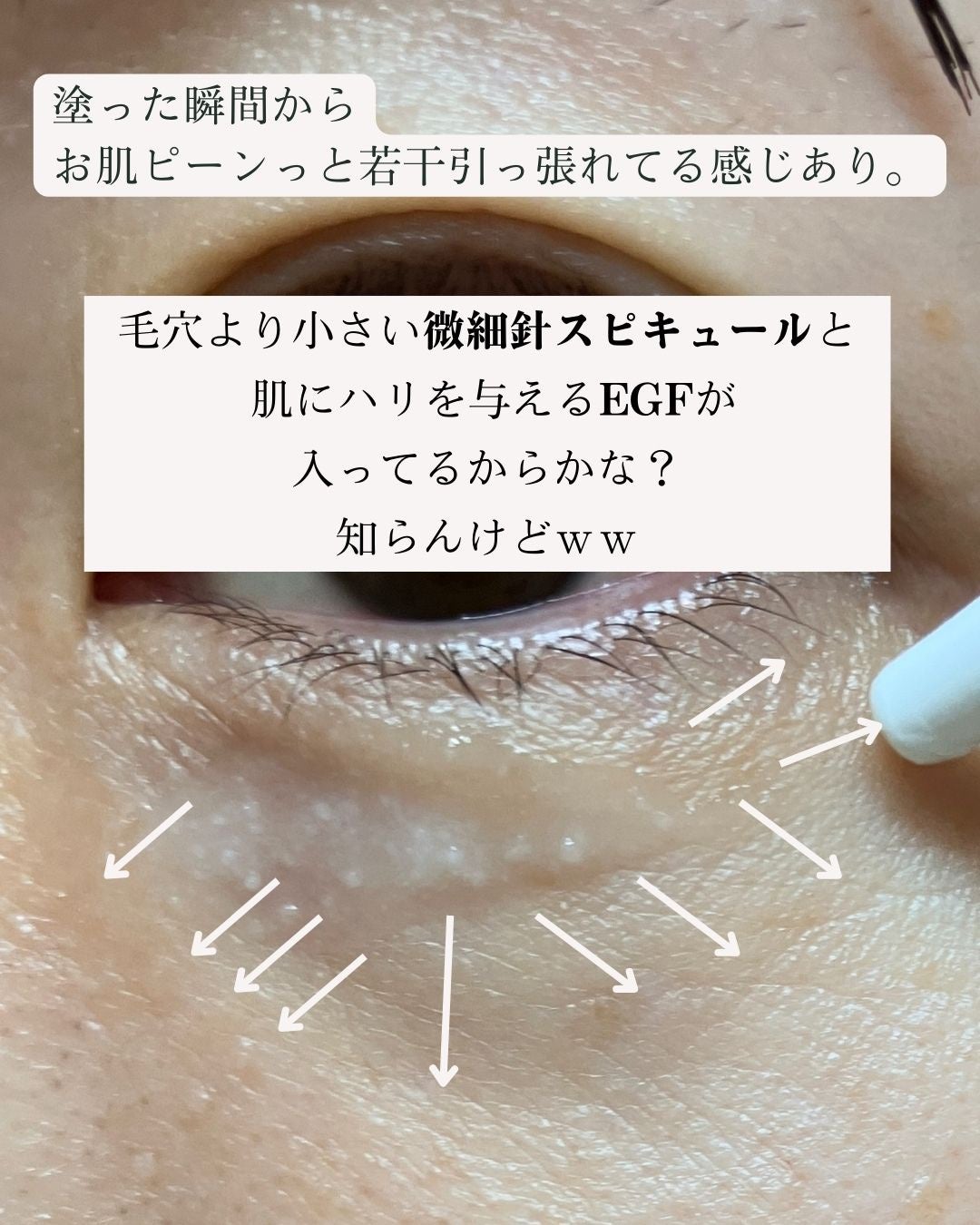 アイファルトアイバッククリーム/Dr.Melaxin/アイケア・アイクリームを使ったクチコミ(6枚目)