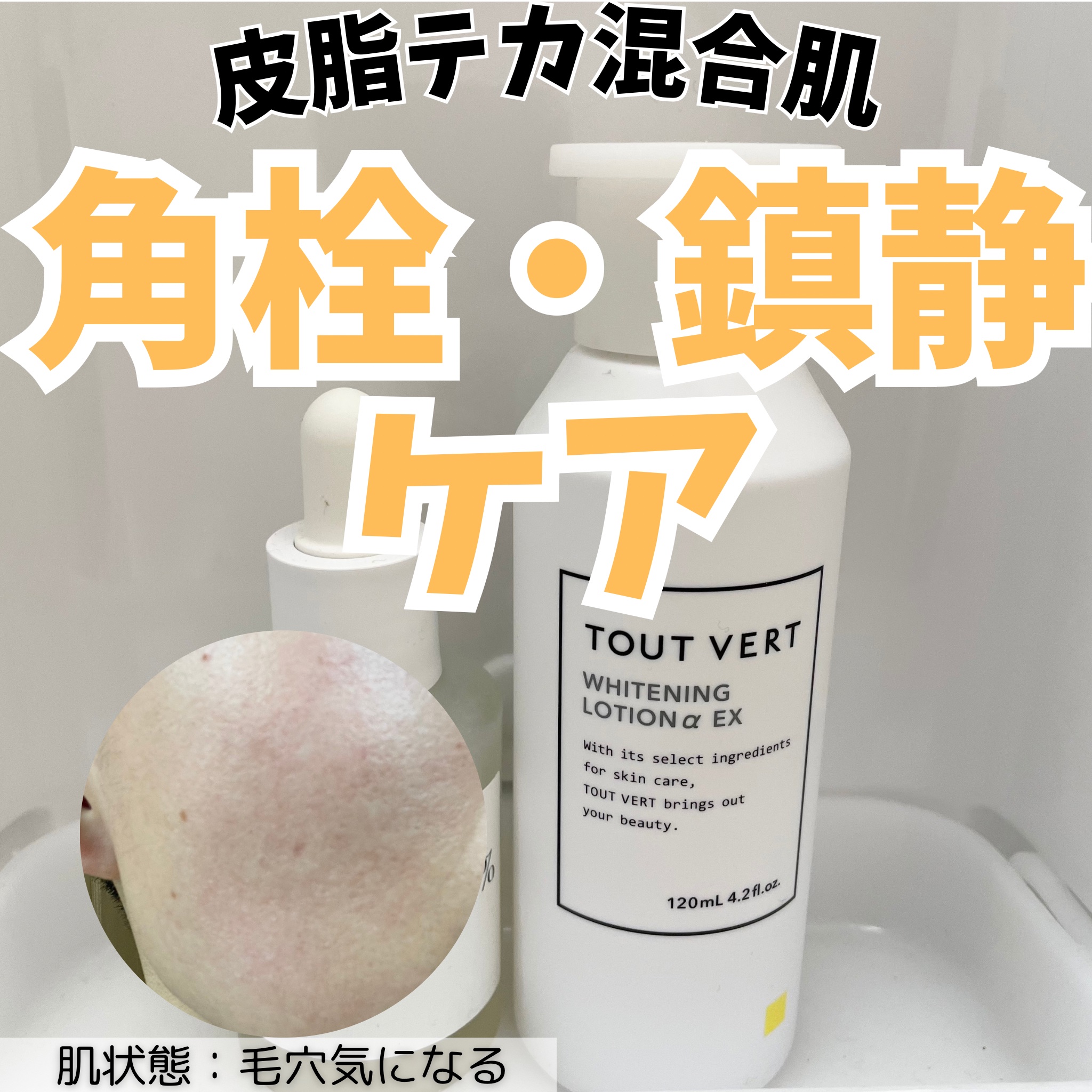 薬用ホワイトニングローションα EX/TOUT VERT/化粧水を使ったクチコミ（1枚目）