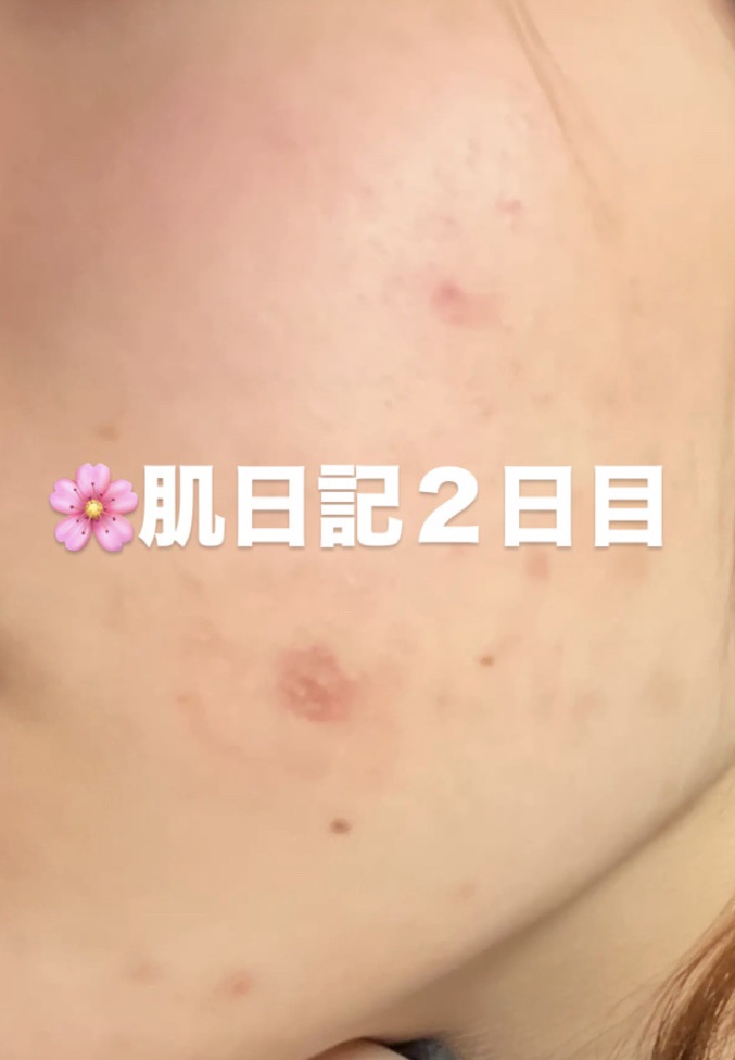 を使ったクチコミ（1枚目）