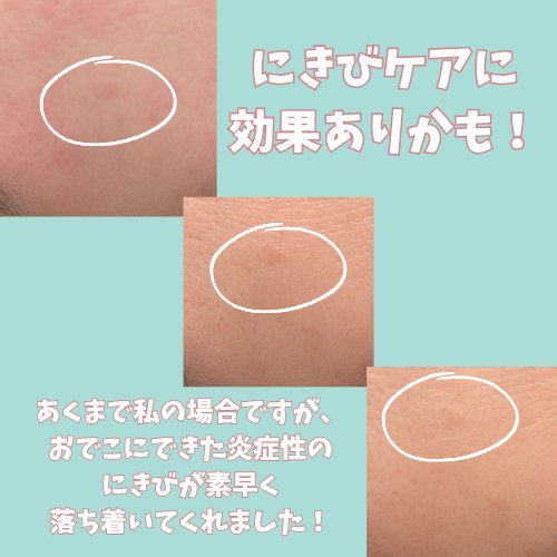 AZケア クレンジングオイル/VT/オイルクレンジングを使ったクチコミ（3枚目）