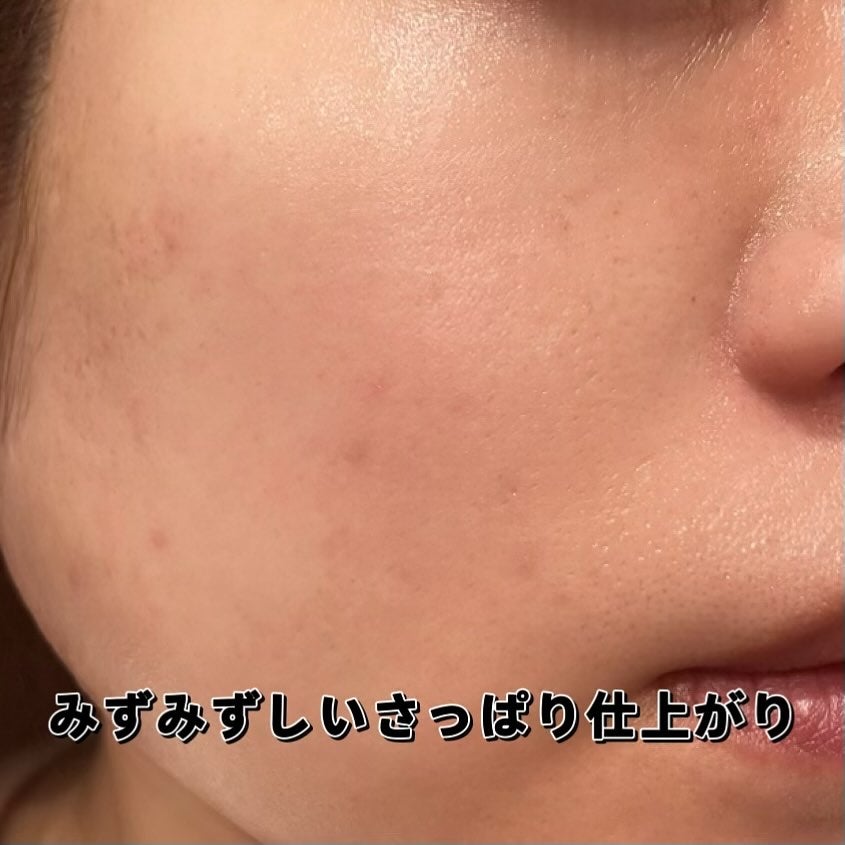 PDRNショット675/COSNORI/美容液を使ったクチコミ(7枚目)