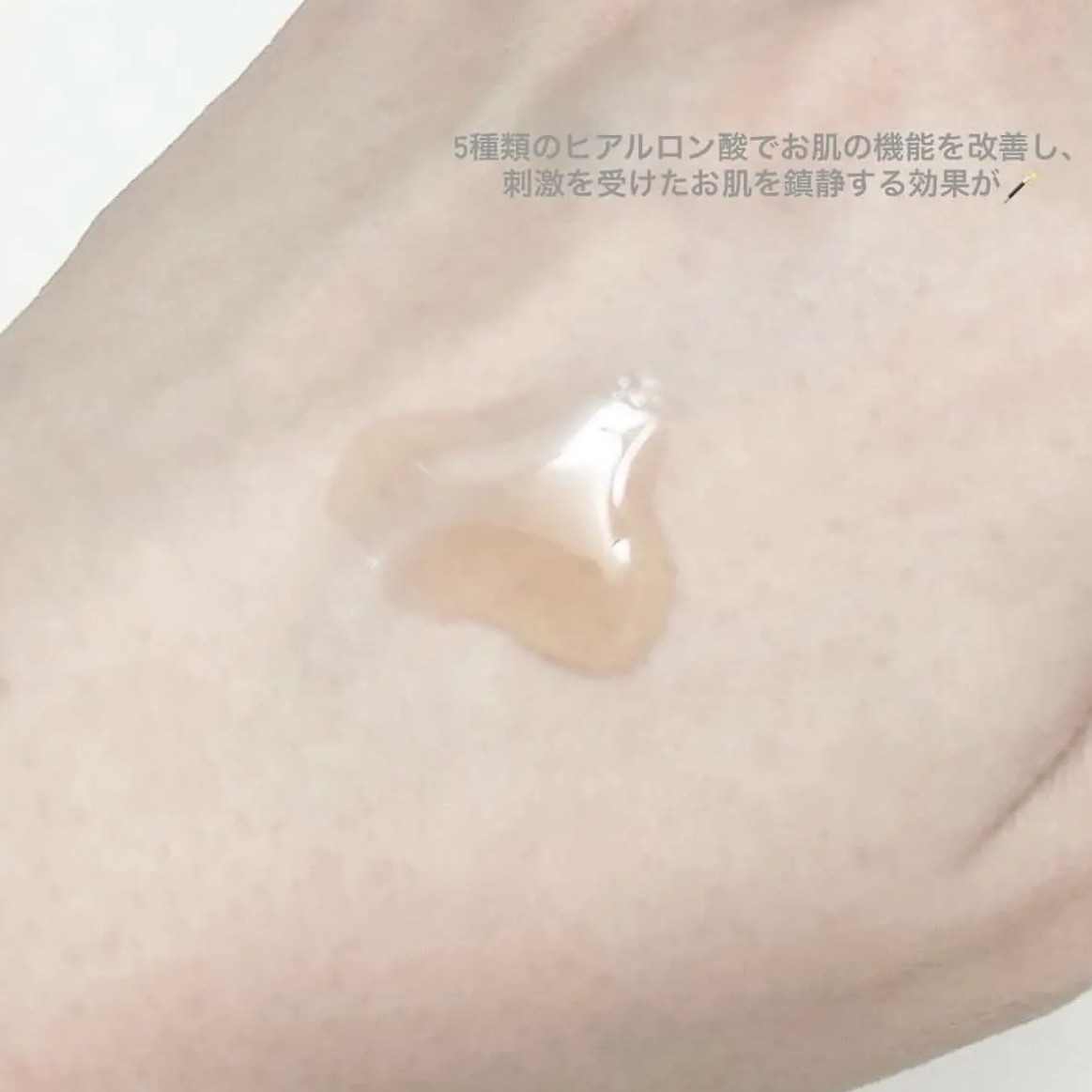 RXザ・アルファアルブチン2 ニキビ跡ケアセラム/COSRX/美容液を使ったクチコミ（3枚目）