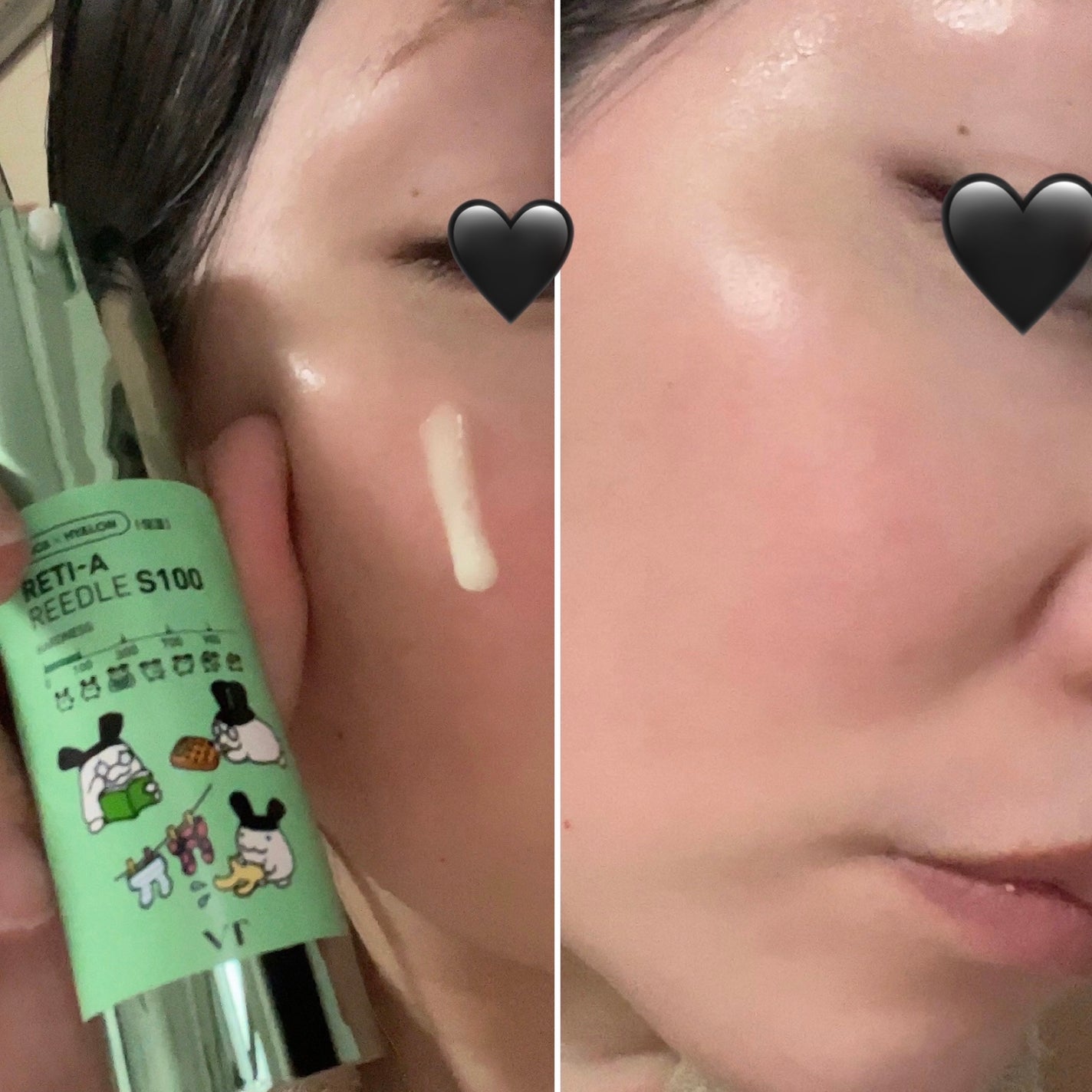 リードルショット100/VT/美容液を使ったクチコミ(5枚目)