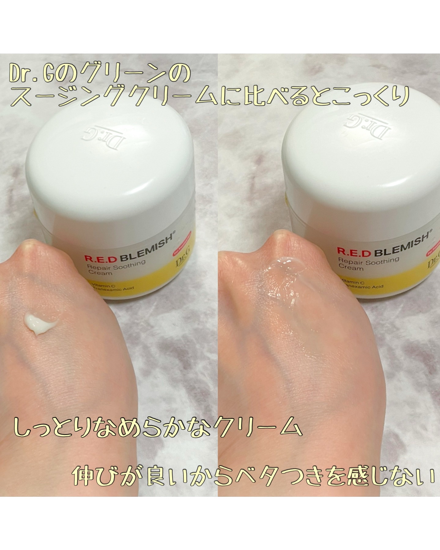 レッドブレミッシュ リペアスージングクリーム/Dr.G/フェイスクリームを使ったクチコミ（3枚目）
