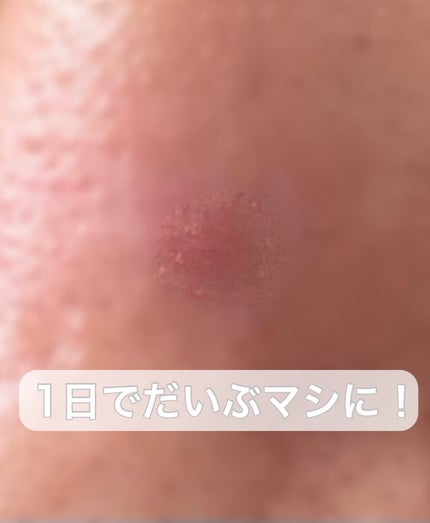 オリーブヤング ケアプラス/Olive Young/その他を使ったクチコミ(6枚目)