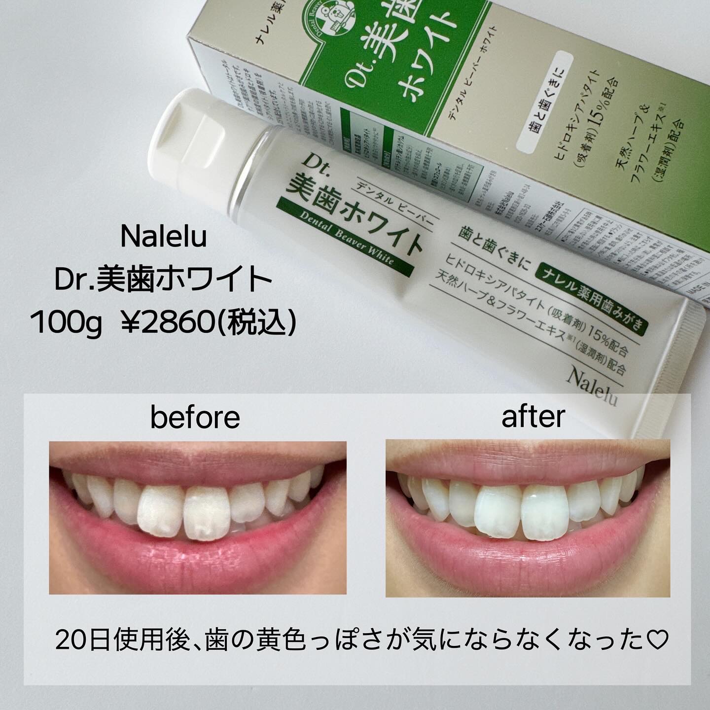 を使ったクチコミ（2枚目）