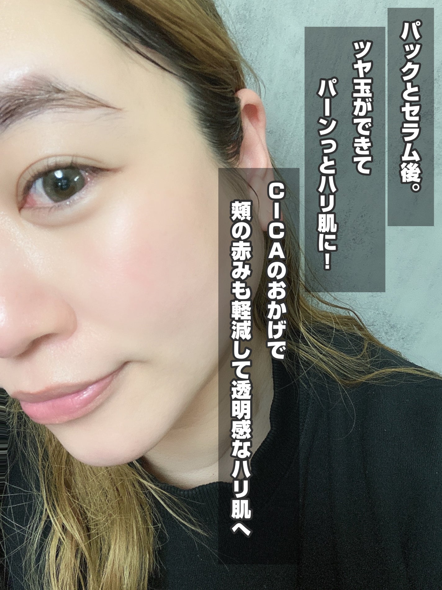 R5ファーミング アンプル/VT/美容液を使ったクチコミ(5枚目)