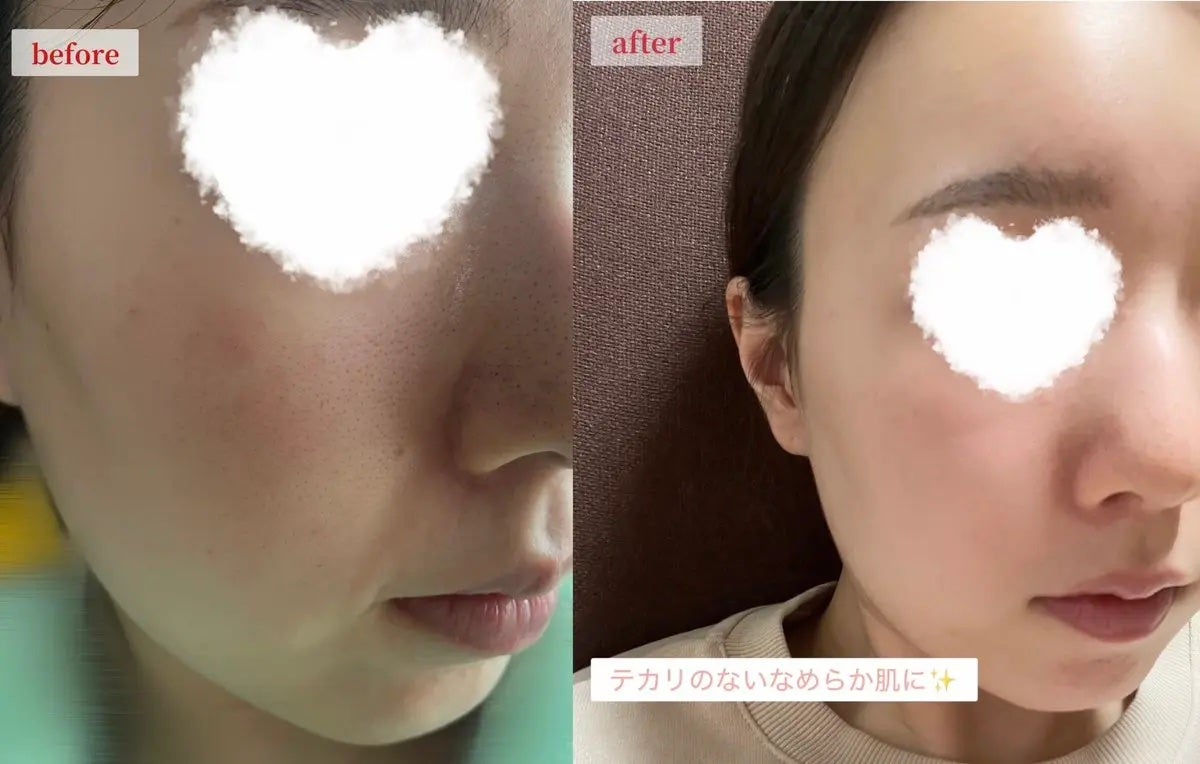 AZケア マスク/VT/シートマスク・パックを使ったクチコミ(3枚目)