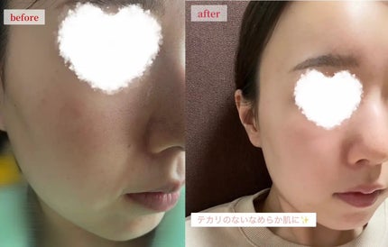 AZケア マスク/VT/シートマスク・パックを使ったクチコミ(3枚目)