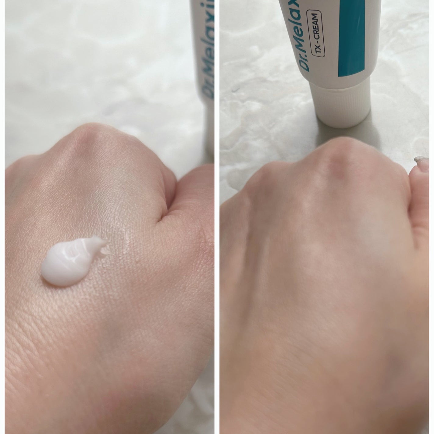 TX-Cream/Dr.Melaxin/フェイスクリームを使ったクチコミ(6枚目)
