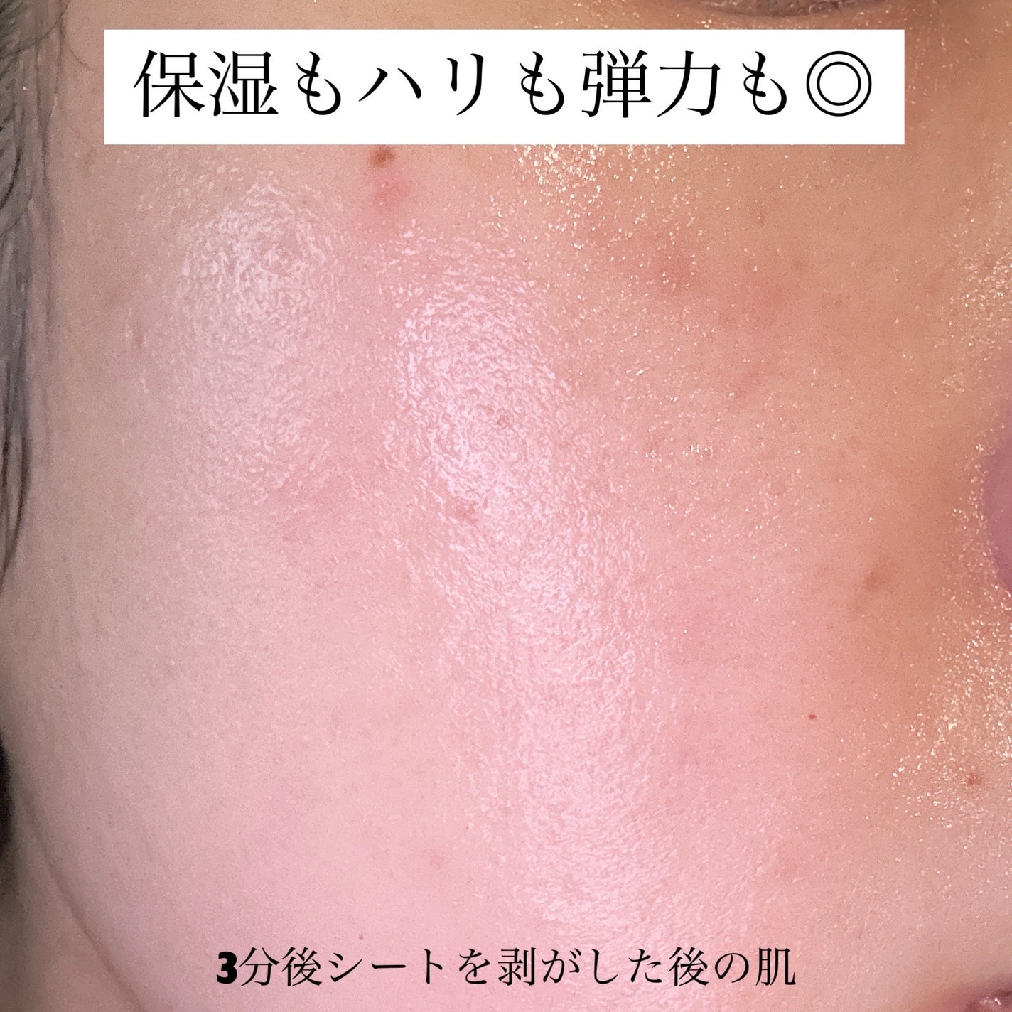 ダーマレーザー スーパーセラミド100マスク/クオリティファースト/シートマスク・パックを使ったクチコミ(4枚目)