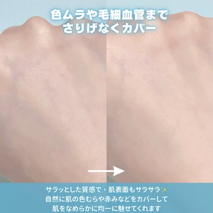 ãµã çŽ èèšå¿µæ¥ è¬çšã¹ãã³ã±ã¢ããŠã㌠ACãã¯ã€ããå»è¬éšå€åã/çŽ èèšå¿µæ¥/ãã¬ã¹ãããŠããŒã䜿ã£ãã¯ãã³ãïŒ5æç®ïŒ