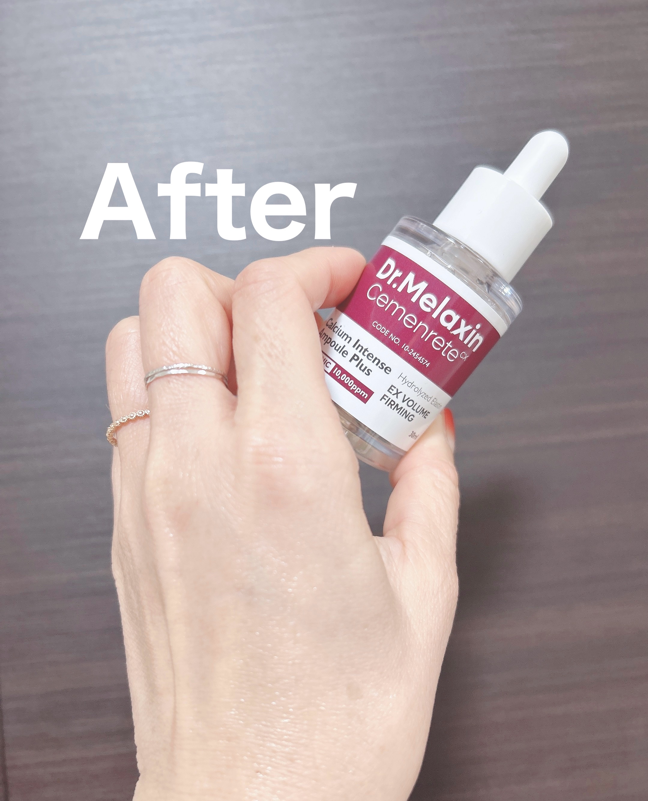 セメンリトカルシウムアンプル+セメンリトカルシウムクリーム/Dr.Melaxin/スキンケアキットを使ったクチコミ（3枚目）