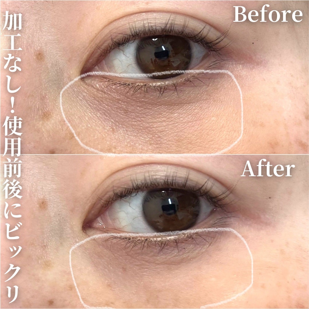 アイファルトアイバッククリーム/Dr.Melaxin/アイケア・アイクリームを使ったクチコミ(4枚目)