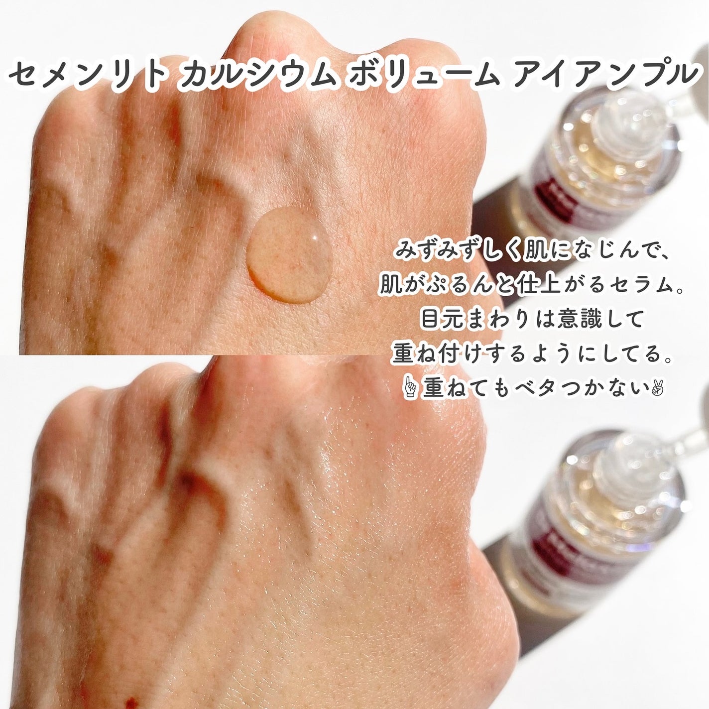 セメンリトカルシウムアンプル+セメンリトカルシウムクリーム/Dr.Melaxin/スキンケアキットを使ったクチコミ(3枚目)