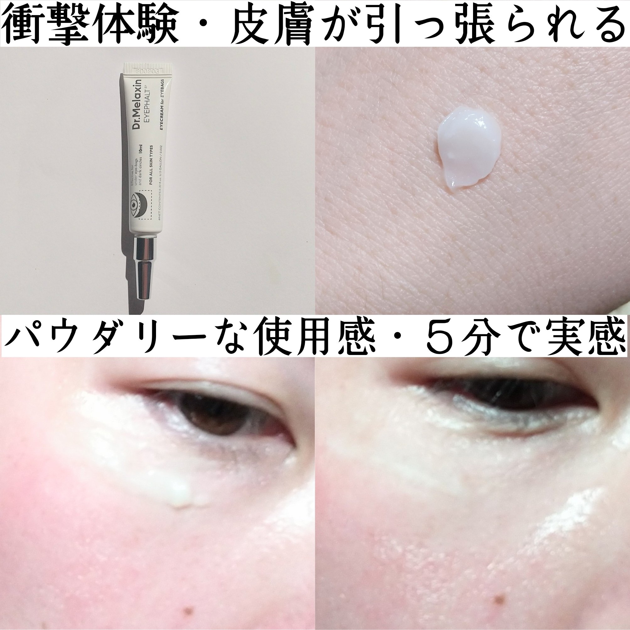 アイファルトアイバッククリーム/Dr.Melaxin/アイケア・アイクリームを使ったクチコミ（2枚目）